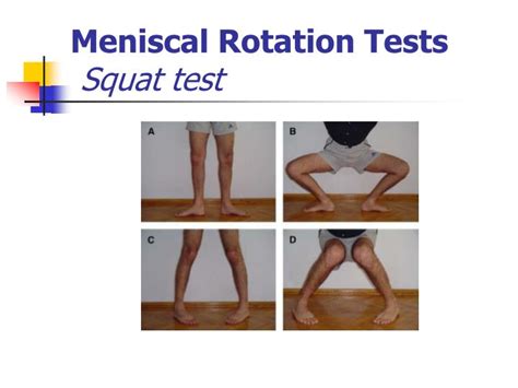 meniscus tear squat test|how to test for meniscus.